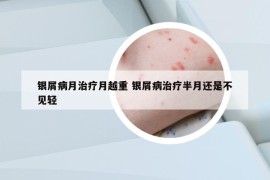 银屑病月治疗月越重 银屑病治疗半月还是不见轻