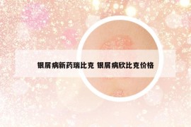 银屑病新药瑞比克 银屑病欣比克价格