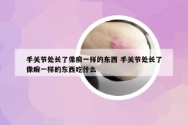 手关节处长了像癣一样的东西 手关节处长了像癣一样的东西吃什么