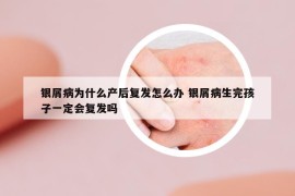 银屑病为什么产后复发怎么办 银屑病生完孩子一定会复发吗