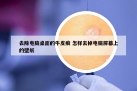 去除电脑桌面的牛皮癣 怎样去掉电脑屏幕上的壁纸