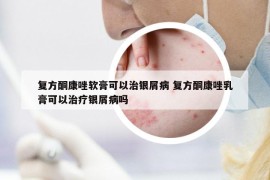 复方酮康唑软膏可以治银屑病 复方酮康唑乳膏可以治疗银屑病吗