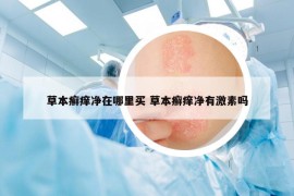 草本癣痒净在哪里买 草本癣痒净有激素吗