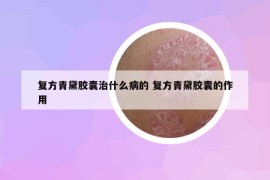 复方青黛胶囊治什么病的 复方青黛胶囊的作用