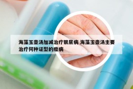 海藻玉壶汤加减治疗银屑病 海藻玉壶汤主要治疗何种证型的瘿病