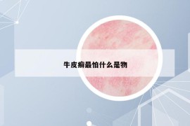 牛皮癣最怕什么是物