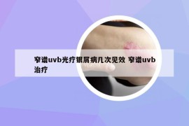 窄谱uvb光疗银屑病几次见效 窄谱uvb治疗