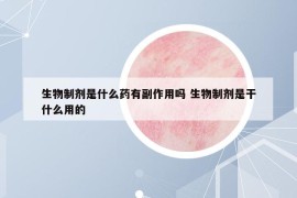 生物制剂是什么药有副作用吗 生物制剂是干什么用的