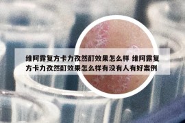 维阿露复方卡力孜然酊效果怎么样 维阿露复方卡力孜然酊效果怎么样有没有人有好案例