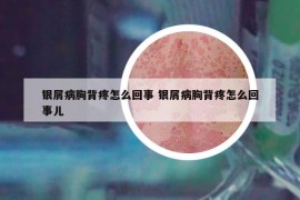 银屑病胸背疼怎么回事 银屑病胸背疼怎么回事儿