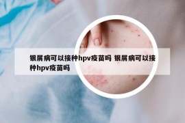 银屑病可以接种hpv疫苗吗 银屑病可以接种hpv疫苗吗