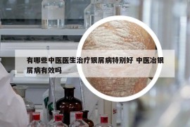 有哪些中医医生治疗银屑病特别好 中医冶银屑病有效吗