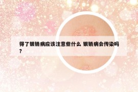 得了银销病应该注意些什么 银销病会传染吗?