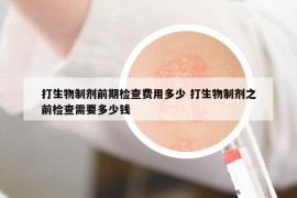 打生物制剂前期检查费用多少 打生物制剂之前检查需要多少钱