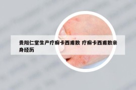 贵阳仁堂生产疗癣卡西甫散 疗癣卡西甫散亲身经历