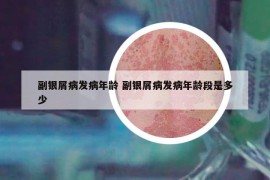 副银屑病发病年龄 副银屑病发病年龄段是多少