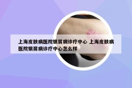 上海皮肤病医院银屑病诊疗中心 上海皮肤病医院银屑病诊疗中心怎么样