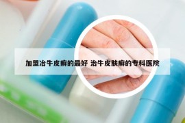 加盟冶牛皮癣的最好 治牛皮肤癣的专科医院