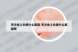 天冷身上长癣什么原因 天冷身上长癣什么原因呢