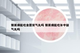 银屑病能吃金匮肾气丸吗 银屑病能吃补中益气丸吗