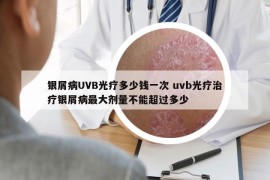 银屑病UVB光疗多少钱一次 uvb光疗治疗银屑病最大剂量不能超过多少