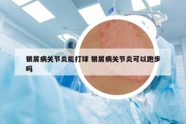 银屑病关节炎能打球 银屑病关节炎可以跑步吗