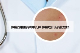 体癣口服用药有哪几种 体癣吃什么药比较好