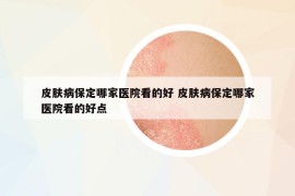 皮肤病保定哪家医院看的好 皮肤病保定哪家医院看的好点