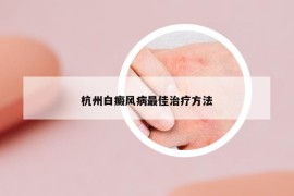 杭州白癜风病最佳治疗方法