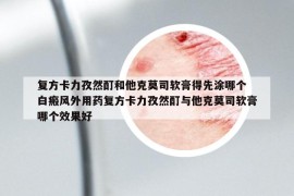 复方卡力孜然酊和他克莫司软膏得先涂哪个 白瘢风外用药复方卡力孜然酊与他克莫司软膏哪个效果好