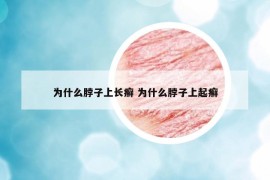 为什么脖子上长癣 为什么脖子上起癣