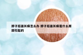 脖子后面长癣怎么办 脖子后面长癣是什么原因引起的