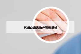 苏州白癜风治疗到哪里好