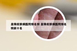 盘锦皮肤病医院排名榜 盘锦皮肤病医院排名榜前十名