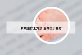 白斑治疗土方法 治白斑小偏方