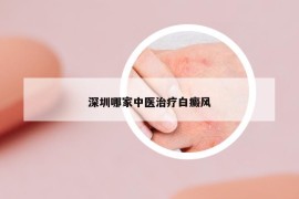 深圳哪家中医治疗白癜风