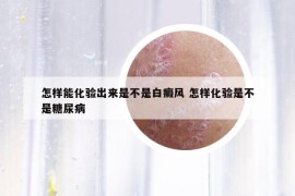 怎样能化验出来是不是白癜风 怎样化验是不是糖尿病