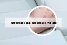 本维莫德乳膏效果 本维莫德乳膏使用说明