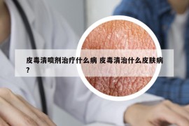 皮毒清喷剂治疗什么病 皮毒清治什么皮肤病?