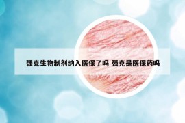 强克生物制剂纳入医保了吗 强克是医保药吗