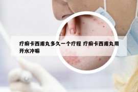 疗癣卡西甫丸多久一个疗程 疗癣卡西甫丸用开水冲嘛