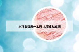 小孩皮藓用什么药 儿童皮肤皮藓