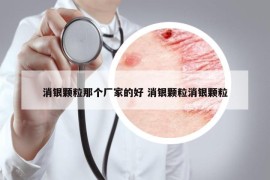 消银颗粒那个厂家的好 消银颗粒消银颗粒