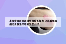 上海看银屑病闵自强治疗不复发 上海看银屑病闵自强治疗不复发怎么样