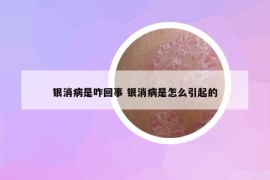 银消病是咋回事 银消病是怎么引起的