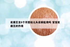 皮康王主8个月婴幼儿头皮癣能用吗 宝宝皮康王的作用