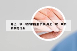 身上一块一块白的是什么病 身上一块一块白白的是什么