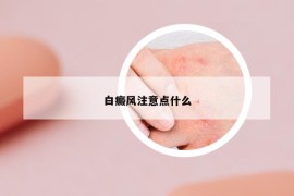 白癜风注意点什么