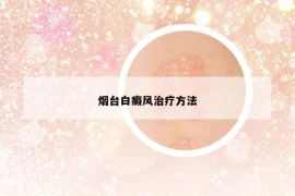 烟台白癜风治疗方法