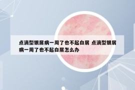 点滴型银屑病一周了也不起白屑 点滴型银屑病一周了也不起白屑怎么办